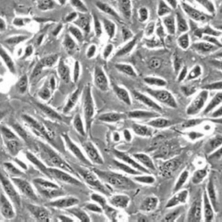 Human Renal Proximal Tubular Epithelial Cells