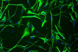Immortalized Human Cortical Astrocytes