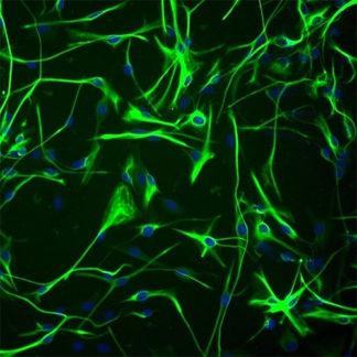 Immortalized Human Cortical Astrocytes