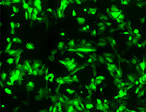 Green Fluorescent Immortalized Human Brain Microvascular Endothelial Cells