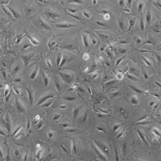 Immortalized Human Conjunctival Epithelial Cells