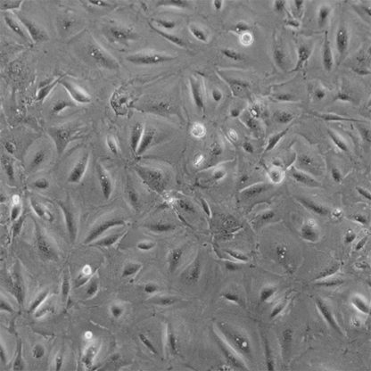 Immortalized Human Conjunctival Epithelial Cells