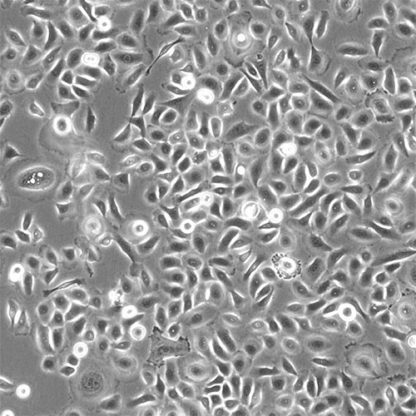 Immortalized Human Corneal Epithelial Cells