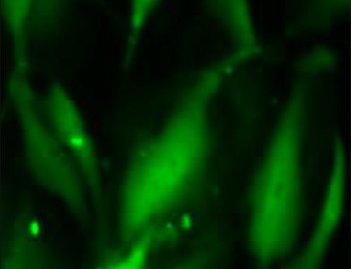 Green Fluorescent Immortalized Human Dermal Microvascular Endothelial Cells