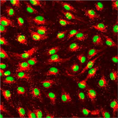 Immortalized Human Retinal Endothelial Cells