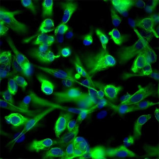 Human Renal Proximal Tubular Epithelial Cells – Cells Online