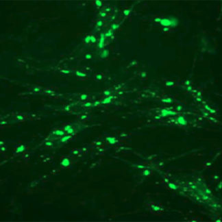 Fluorescent Adrenergic Receptor beta2 Internalization Assay Cell Line