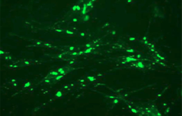 Fluorescent Adrenergic Receptor beta2 Internalization Assay Cell Line