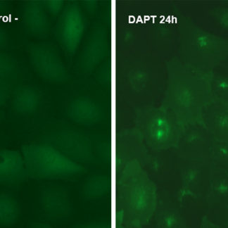 Alzheimer's Disease Model: Gamma-secretase Activity Assay Cell Line
