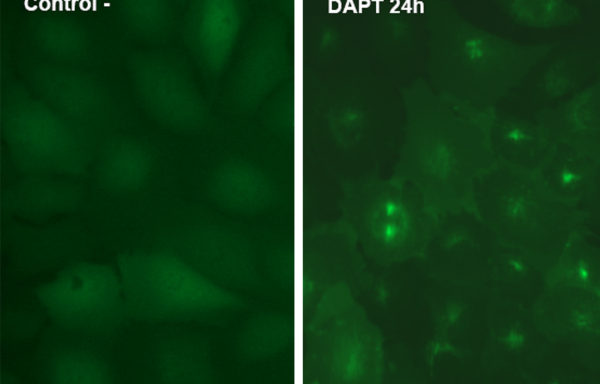 Alzheimer’s Disease (AD) Model: Gamma-secretase Activity Assay Cell Line
