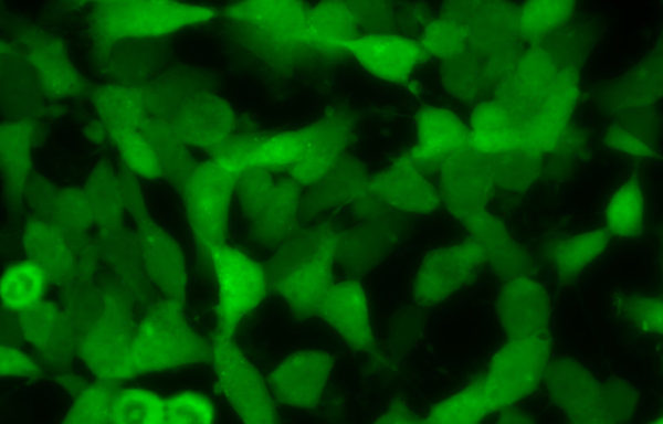 SH-SY5Y cell line stably expressing Green Fluorescent alpha-synuclein