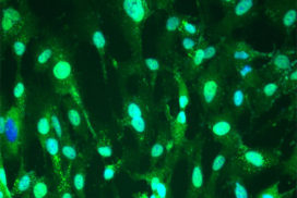 Pancreatic Stromal Cells