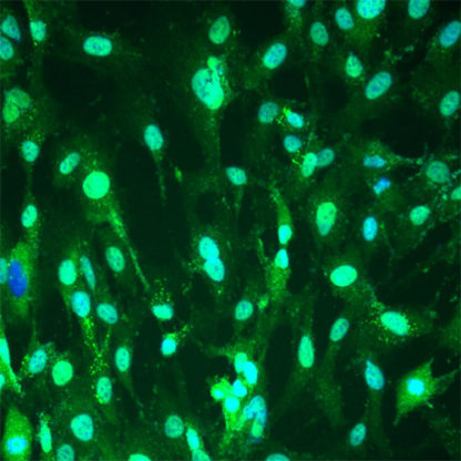 Pancreatic Stromal Cells