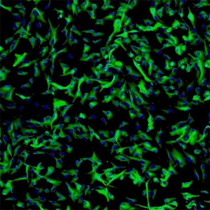 Human Cerebellar Astrocytes