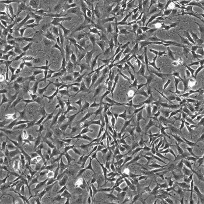 Human Cerebellar Astrocytes