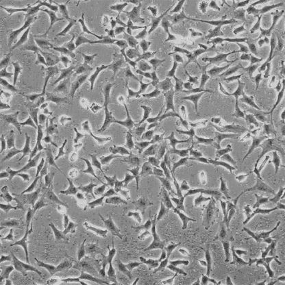 Human Spinal Cord Astrocytes