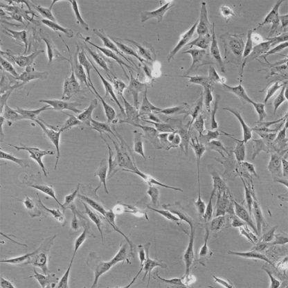 Human Adrenal Cortical Cells