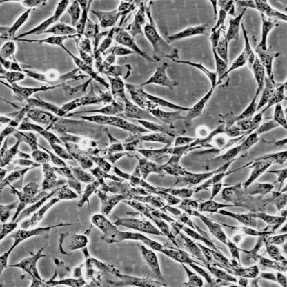 Human Adrenal Fibroblasts