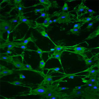 Human Adrenal Fibroblasts