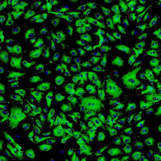 Human Adipose Microvascular Endothelial Cells