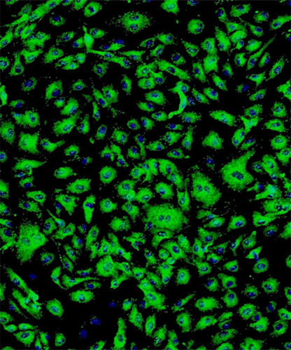 Human Adipose Microvascular Endothelial Cells