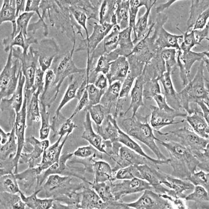 Human Adrenal Microvascular Endothelial cells