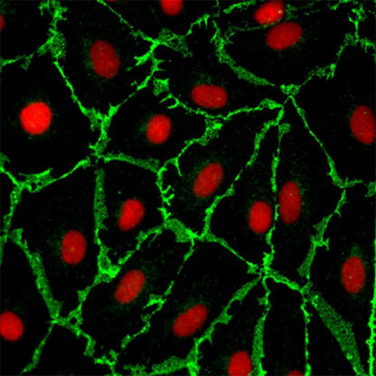 Human Adrenal Microvascular Endothelial cells