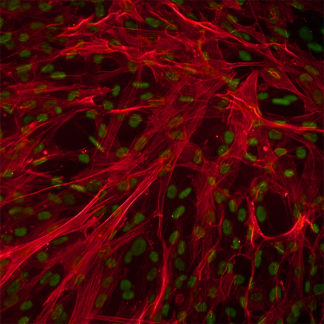Human Aortic Smooth Muscle cells