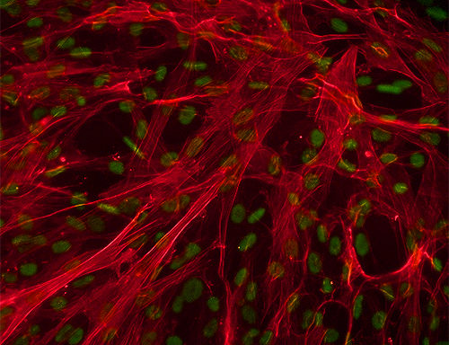 Human Aortic Smooth Muscle Cells
