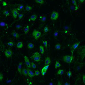 Human Brain Microvascular Endothelial Cells