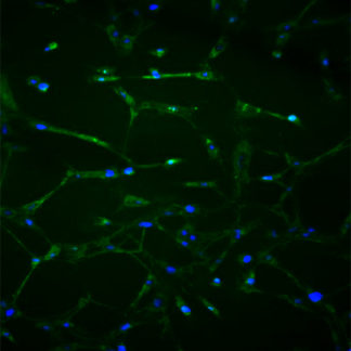 Human Brain Vascular Adventitial Fibroblasts