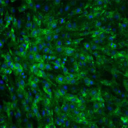 Human Brain Vascular Pericytes