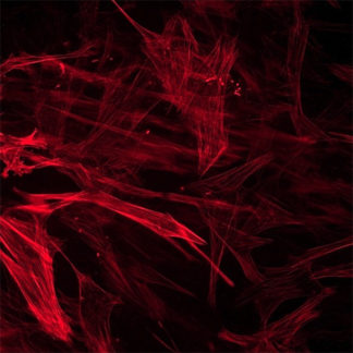 Human Brain Vascular Smooth Muscle Cells