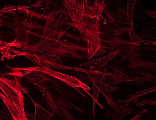 Human Brain Vascular Smooth Muscle Cells