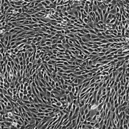 Human Colonic Fibroblasts