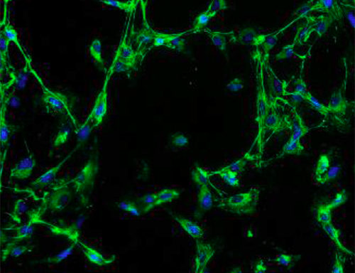 Green Fluorescent Human Colonic Fibroblasts