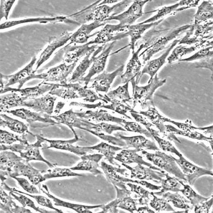 Human Colonic Smooth Muscle Cells