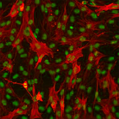 Human Colonic Smooth Muscle Cells