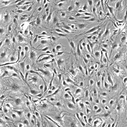 Human Choroid Plexus Endothelial Cells