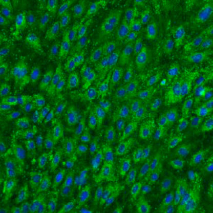 Human Choroid Plexus Endothelial Cells