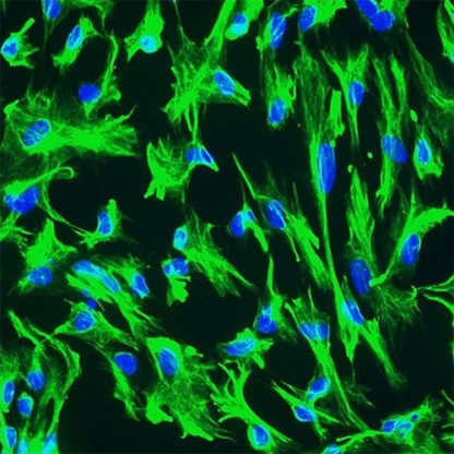 Human Choroid Plexus Epithelial Cells