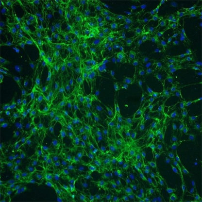 Human Choroid Plexus Fibroblasts