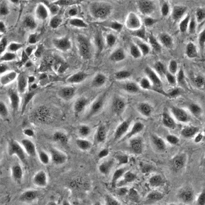 Human Dermal Lymphatic Endothelial cells