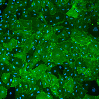 Human Dermal Lymphatic Endothelial cells