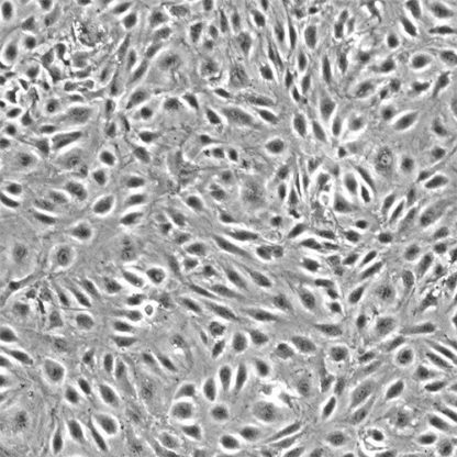 Human Dermal Microvascular Endothelial cells