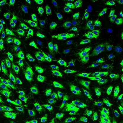 Human Dermal Microvascular Endothelial cells