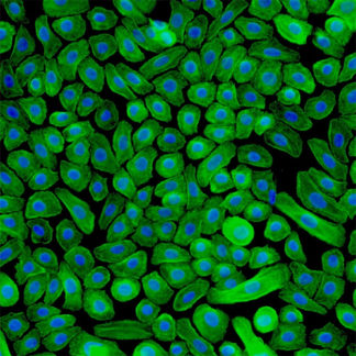 Human Epidermal Keratinocytes