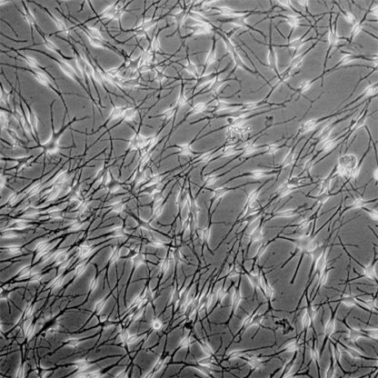 Human Epidermal Melanocytes