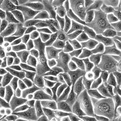 Human Esophageal Epithelial Cells