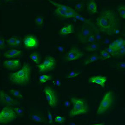 Human Esophageal Epithelial Cells